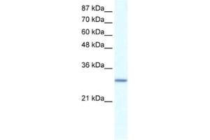 Western Blotting (WB) image for anti-General Transcription Factor IIE, Polypeptide 2 (GTF2E2) antibody (ABIN2460220)