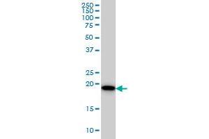 SRI monoclonal antibody (M01), clone 1E12 Western Blot analysis of SRI expression in HeLa . (SRI Antikörper  (AA 1-198))