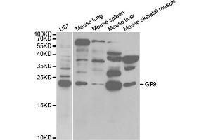 Western Blotting (WB) image for anti-Glycoprotein IX (Platelet) (GP9) antibody (ABIN1876562) (CD42a Antikörper)
