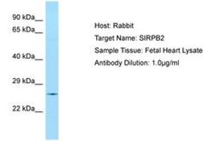 Image no. 1 for anti-Signal-Regulatory Protein beta 2 (SIRPb2) (AA 110-159) antibody (ABIN6750071) (SIRPb2 Antikörper  (AA 110-159))