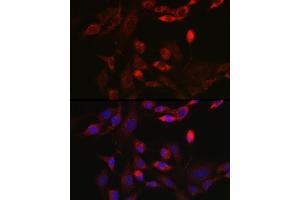 Immunofluorescence analysis of NIH/3T3 cells using BNIP3L Rabbit pAb (ABIN6129989, ABIN6137622, ABIN6137623 and ABIN6221881) at dilution of 1:100 (40x lens). (BNIP3L/NIX Antikörper  (AA 1-187))