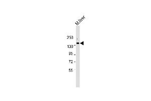 Anti-ATP7B Antibody (C-term) at 1:2000 dilution + Mouse liver lysate Lysates/proteins at 20 μg per lane. (ATP7B Antikörper  (C-Term))