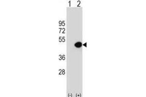Western Blotting (WB) image for anti-Dynactin 2 (p50) (DCTN2) antibody (ABIN2997015) (Dynamitin Antikörper)