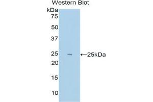 Western blot analysis of the recombinant protein. (EPAS1 Antikörper  (AA 339-541))