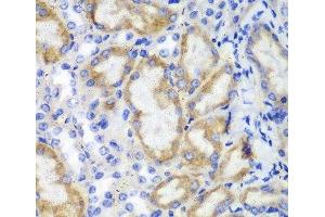 Immunohistochemistry of paraffin-embedded Mouse kidney using HCLS1 Polyclonal Antibody at dilution of 1:100 (40x lens). (HCLS1 Antikörper)