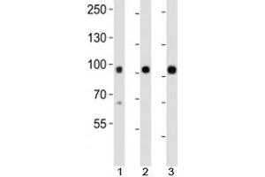 Western blot analysis of lysate from mouse 1) kidney, 2) lung and 3) skin tissue using Epha1 antibody at 1:1000. (EPHA1 Antikörper  (N-Term))
