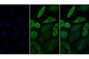 Detection of HSP90aA1 in Human HepG2 cell using Polyclonal Antibody to Heat Shock Protein 90 kDa Alpha A1 (HSP90aA1)