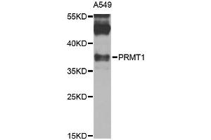 Western blot analysis of extracts of A-549 cells, using PRMT1 antibody (ABIN1874325) at 1:1000 dilution.