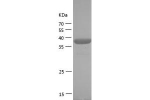 Western Blotting (WB) image for SUMO (AA 2-97) protein (GST tag) (ABIN7281789) (SUMO Protein (AA 2-97) (GST tag))