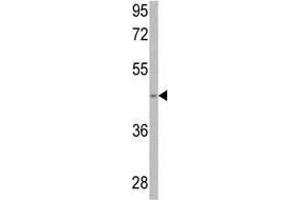Western blot analysis of anti-SPHK1 Antibody (Center) in 293 cell line lysates (35 µg/lane). (SPHK1 Antikörper  (AA 286-315))