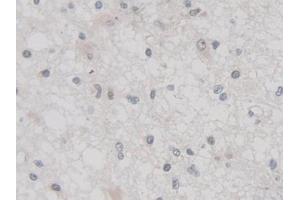 Immunohistochemistry (IHC) image for anti-Tumor Necrosis Factor, alpha-Induced Protein 3 (TNFAIP3) (AA 1-300) antibody (ABIN7443089)