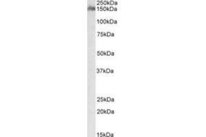 Western Blotting (WB) image for anti-CUB and Sushi Multiple Domains 1 (CSMD1) (Internal Region) antibody (ABIN2464386) (CSMD1 Antikörper  (Internal Region))