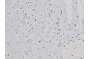 ABIN6267463 at 1/200 staining Human esophagus tissue sections by IHC-P.