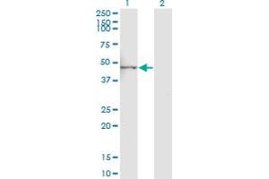 Western Blotting (WB) image for anti-Phospholipase A2, Group XV (PLA2G15) (AA 314-412) antibody (ABIN525357)
