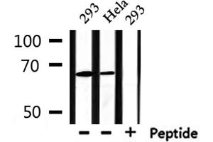 Western Blotting (WB) image for anti-Protein Inhibitor of Activated STAT, 2 (PIAS2) antibody (ABIN6264196)