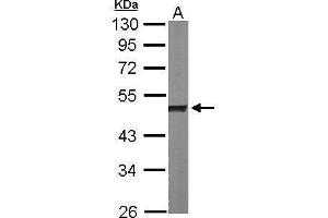 Western Blotting (WB) image for anti-Heterogeneous Nuclear Ribonucleoprotein H1 (H) (HNRNPH1) antibody (ABIN2855275)