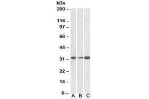Western blot testing of human [A], mouse [B] and rat [C] brain lysate with EB3 antibody at 0. (MAPRE3 Antikörper)