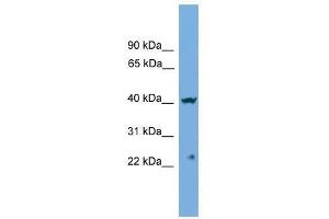 Western Blot showing CENPN antibody used at a concentration of 1-2 ug/ml to detect its target protein. (CENPN Antikörper  (Middle Region))