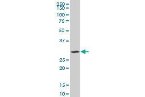 SIX3 monoclonal antibody (M08), clone 2B9. (SIX3 Antikörper  (AA 273-332))