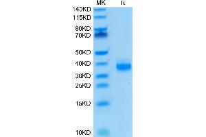 EpCAM Protein (AA 24-265) (His-Avi Tag,Biotin)
