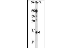BTF3L4 Antibody (C-term) (ABIN657591 and ABIN2846592) western blot analysis in SK-BR-3 cell line lysates (35 μg/lane). (BTF3L4 Antikörper  (C-Term))