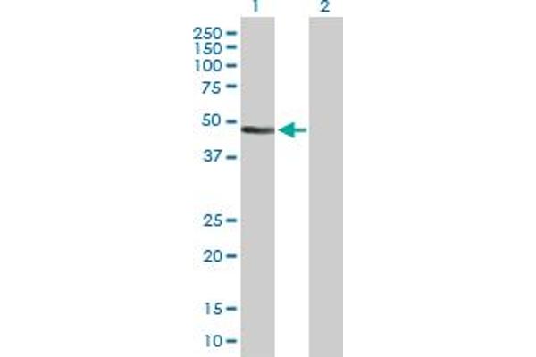 Anillin Antikörper  (AA 1-405)