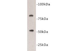 Western Blotting (WB) image for anti-Vitamin K-dependent protein C (PROC) antibody (ABIN1855001) (PROC Antikörper)