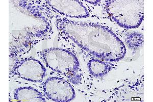 Immunohistochemistry (IHC) image for anti-Interleukin 1 Receptor, Type I (IL1R1) (pTyr496) antibody (ABIN801423)