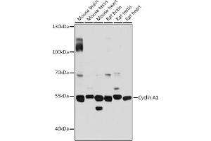 Western blot analysis of extracts of various cell lines, using Cyclin  antibody (4529) at 1:3000 dilution. (Cyclin A1 Antikörper  (AA 350-450))