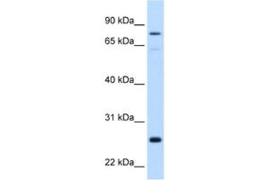 Western Blotting (WB) image for anti-Glutathione S-Transferase mu 2 (Muscle) (GSTM2) antibody (ABIN2462480) (GSTM2 Antikörper)