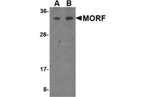 Western blot analysis of MORF4 in K562 cell lysate with MORF4 antibody at (A) 1 and (B) 2 μg/ml. (MORF4 Antikörper  (N-Term))