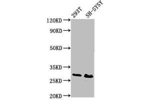 Western Blot Positive WB detected in: 293T whole cell lysate, SH-SY5Y whole cell lysate All lanes: RFXANK antibody at 6. (RFXANK Antikörper  (AA 3-84))