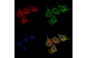 ABIN7094235 and ABIN7098282 staining HepG2 cells by IF/ICC. (Formin 2 Antikörper  (N-Term))