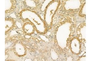 anti-Calmodulin-Like 5 (CALML5) (Internal Region) antibody