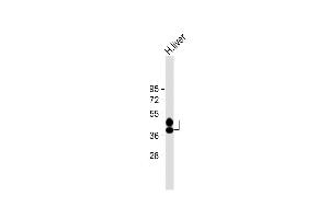 Anti-HP Antibody (Center) at 1:8000 dilution + Human liver lysate Lysates/proteins at 20 μg per lane. (Haptoglobin Antikörper  (Center))