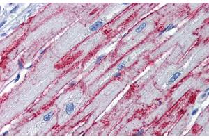 Immunohistochemistry with Human Heart lysate tissue at an antibody concentration of 5.