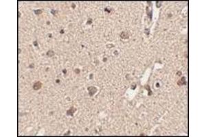 Immunohistochemistry: ATG12 antibody staining of Human brain tissue at 2. (ATG12 Antikörper  (N-Term))