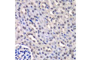 Immunohistochemistry of paraffin-embedded mouse kidney using HNRNPM antibody (ABIN5975447) at dilution of 1/100 (40x lens). (HNRNPM Antikörper)