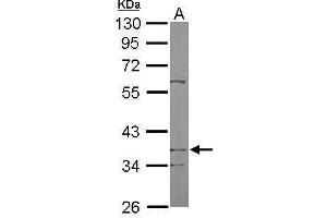 WB Image Sample (50 ug of whole cell lysate) A: Mouse brain 10% SDS PAGE antibody diluted at 1:1000 (PDSS2 Antikörper)