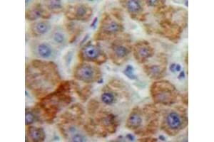 Used in DAB staining on fromalin fixed paraffin-embedded Liver tissue