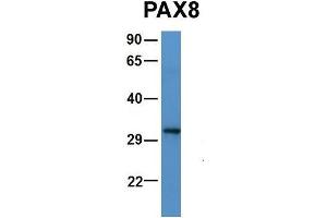 Host:  Rabbit  Target Name:  PAX8  Sample Type:  Human 721_B  Antibody Dilution:  1. (PAX5 Antikörper  (N-Term))