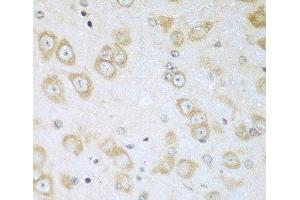 Immunohistochemistry of paraffin-embedded Mouse brain using ACOX1 Polyclonal Antibody at dilution of 1:100 (40x lens). (ACOX1 Antikörper)
