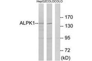 Western blot analysis of extracts from COLO/HepG2 cells, using ALPK1 Antibody.