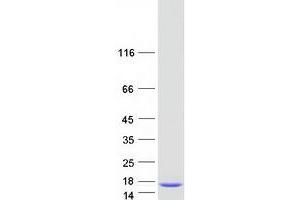 Western Blotting (WB) image for Dynein, Light Chain, LC8-Type 1 (DYNLL1) (Transcript Variant 3) protein (Myc-DYKDDDDK Tag) (ABIN2719878)