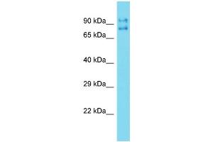 Western Blotting (WB) image for anti-Tigger Transposable Element Derived 5 (TIGD5) (N-Term) antibody (ABIN2774522) (TIGD5 Antikörper  (N-Term))