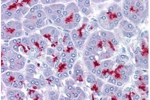 Pancreas, Human: Formalin-Fixed, Paraffin-Embedded (FFPE) (MUC1 Antikörper)