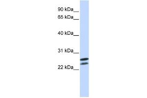 WB Suggested Anti-HOXB4 Antibody   Titration: 1 ug/ml   Positive Control: Jurkat Whole Cell (HOXB4 Antikörper  (N-Term))