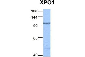 Host:  Rabbit  Target Name:  XPO1  Sample Type:  Hela  Antibody Dilution:  1. (XPO1 Antikörper  (C-Term))