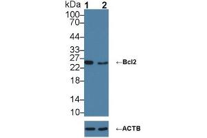 Western blot analysis of (1) Wild-type HL-60 cell lysate, and (2) Bcl2 knockout HL-60 cell lysate, using Rabbit Anti-Mouse BCL2 Antibody (5 µg/ml) and HRP-conjugated Goat Anti-Mouse antibody (abx400001, 0. (Bcl-2 Antikörper  (AA 2-208))