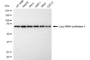 Western blotting analysis using lysyl-tRNA synthetase 1 antibody (ABIN7800951).